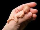 15 milyon premat�re bebek!