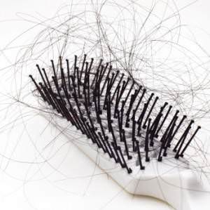 Saçınız hazır mı? causesofhairloss2 d Saçınız hazır mı?