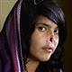Top press award for photo of disfigured Afghan woman