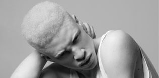 Güzellik standartlarına karşı mücadele ediyor