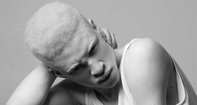 Güzellik standartlarına karşı mücadele ediyor