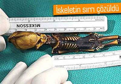 15 santimlik iskelet insana aitmiş