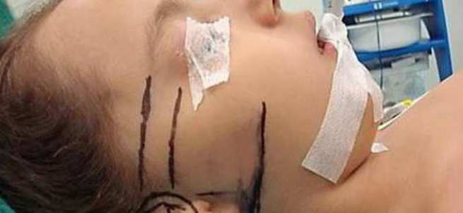 Türk doktor göğüs kafesinden kulak yaptı