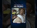 Doktorları şaşırtan nadir durum: Organları ters yerleşimli